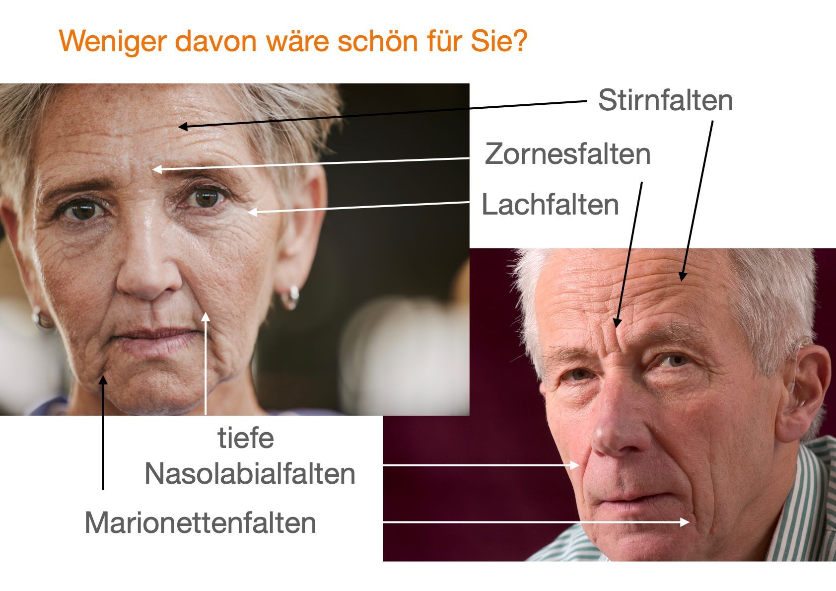Übersicht verschiedener Arten von Gesichtsfalten